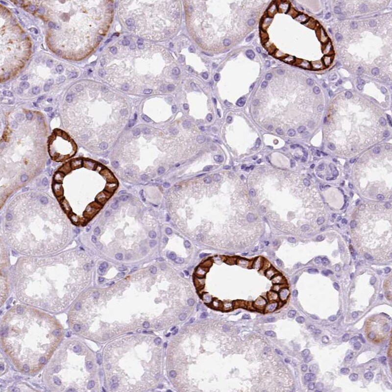 Aquaporin 3 Antibody (PA5-53257)