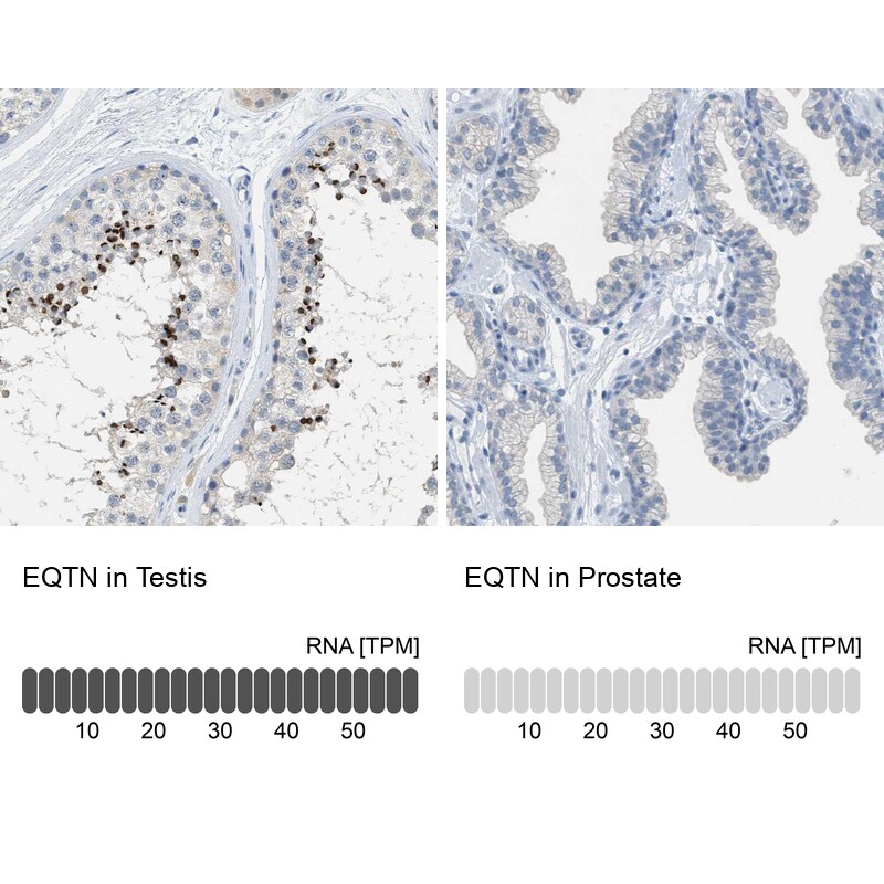 EQTN Antibody in Immunohistochemistry (IHC)