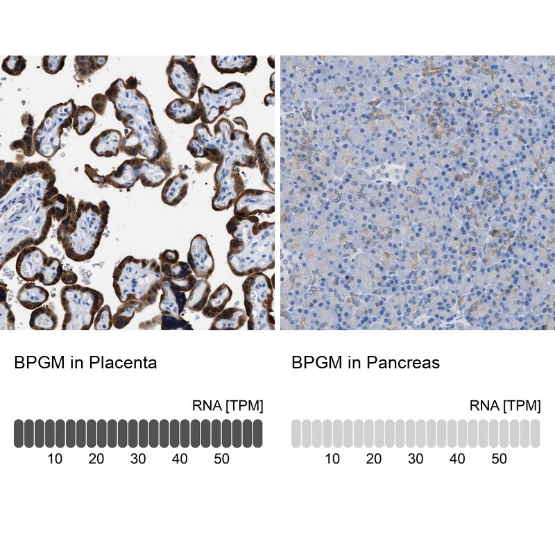 Bisphosphoglycerate mutase Antibody in Immunohistochemistry (IHC)