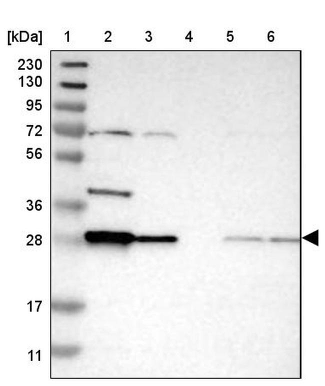 Bisphosphoglycerate mutase Antibody in Western Blot (WB)