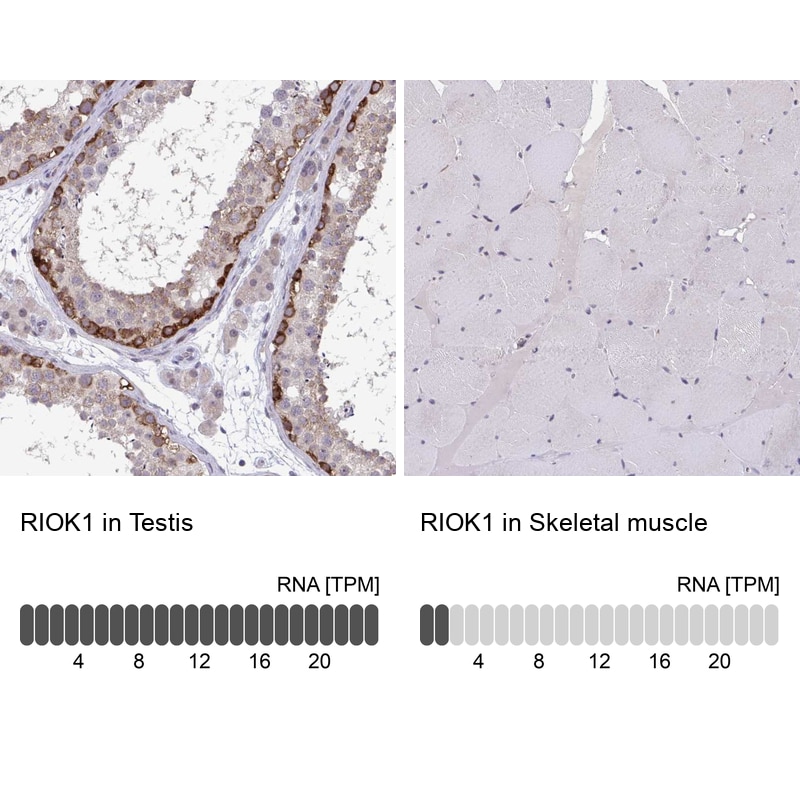 RIOK1 Antibody in Immunohistochemistry (IHC)