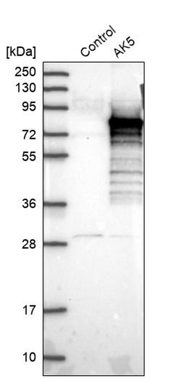 Adenylate Kinase 5 Antibody in Western Blot (WB)