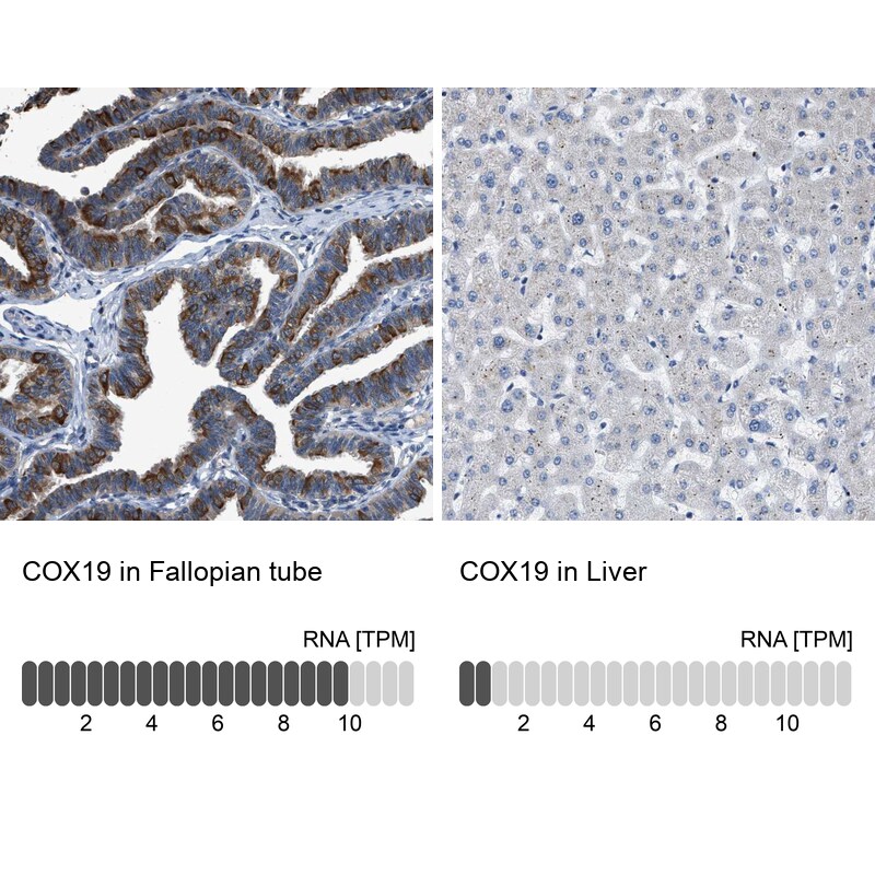 COX19 Antibody in Immunohistochemistry (IHC)