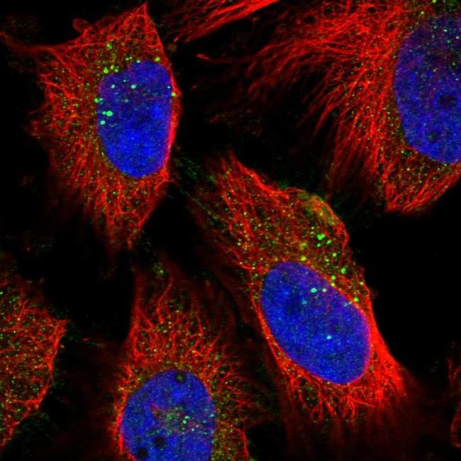 NEU1 Antibody (PA5-54430)