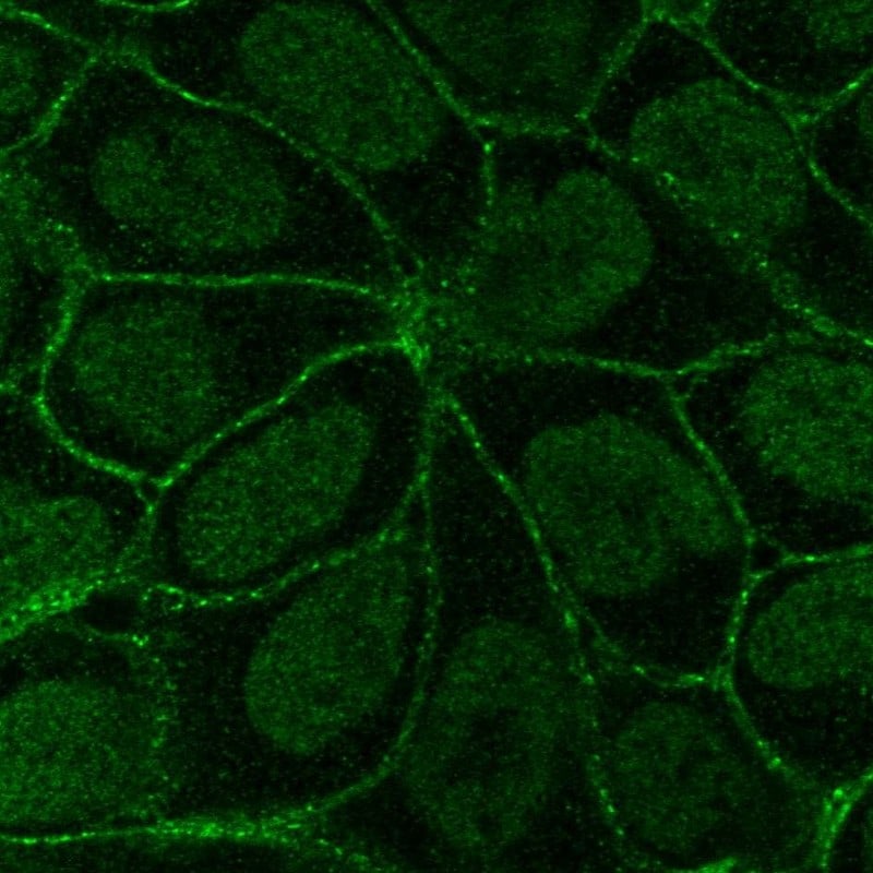 ITGB6 Antibody (PA5-54848)