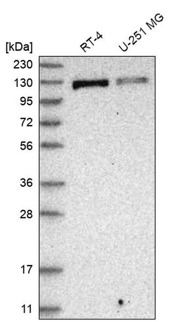 RECQ4 Antibody in Western Blot (WB)