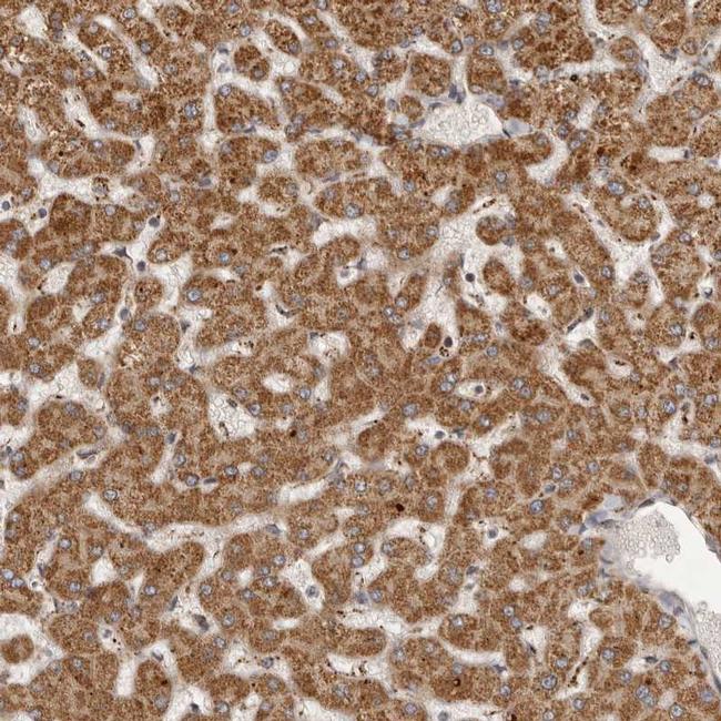 SEMA3A Antibody (PA5-56149)