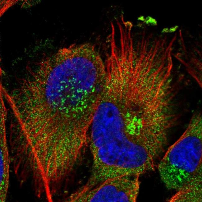 PISD Antibody (PA5-56634)