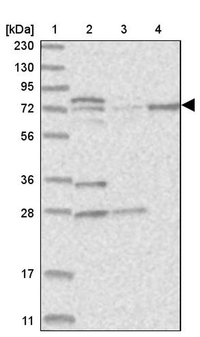 KLHL17 Antibody in Western Blot (WB)