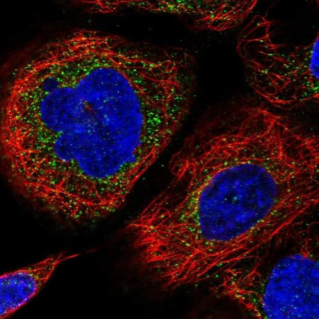 HLA-E Antibody (PA5-56752)