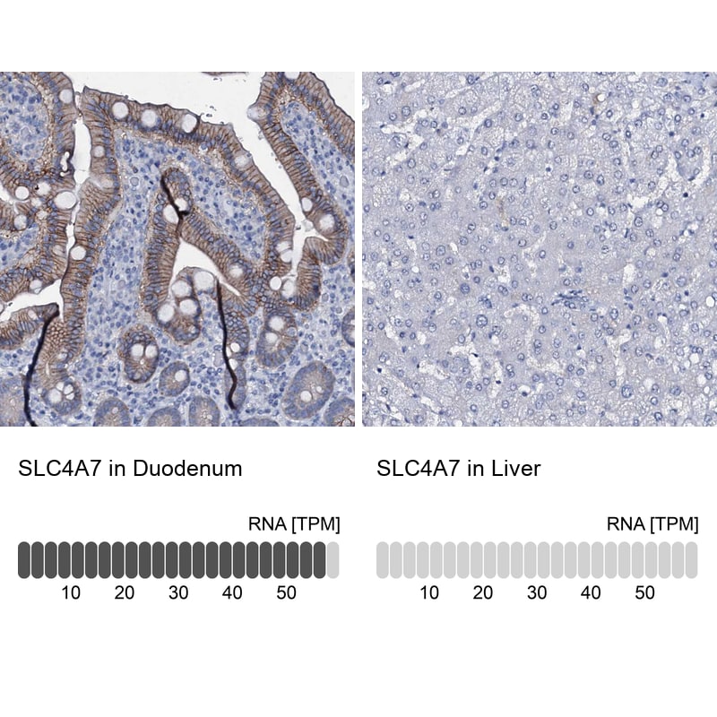 SLC4A7 Antibody in Immunohistochemistry (IHC)