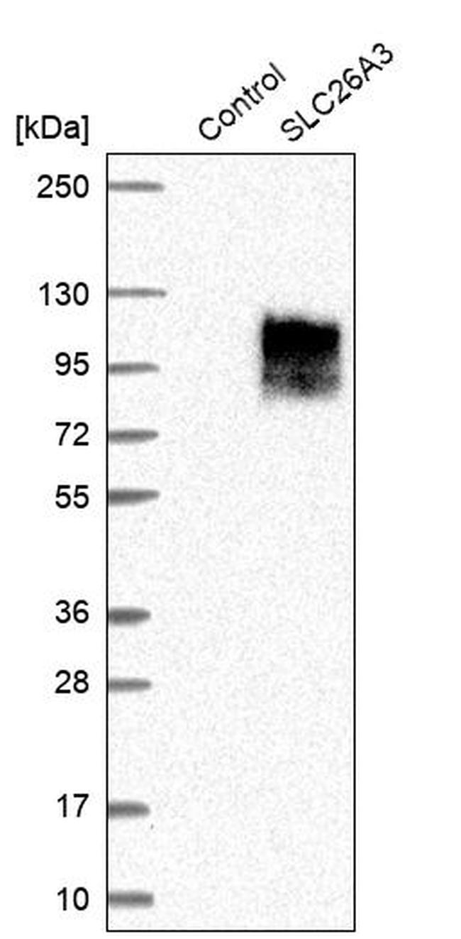 SLC26A3 Antibody in Western Blot (WB)