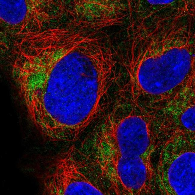 TOMM40 Antibody (PA5-57575)