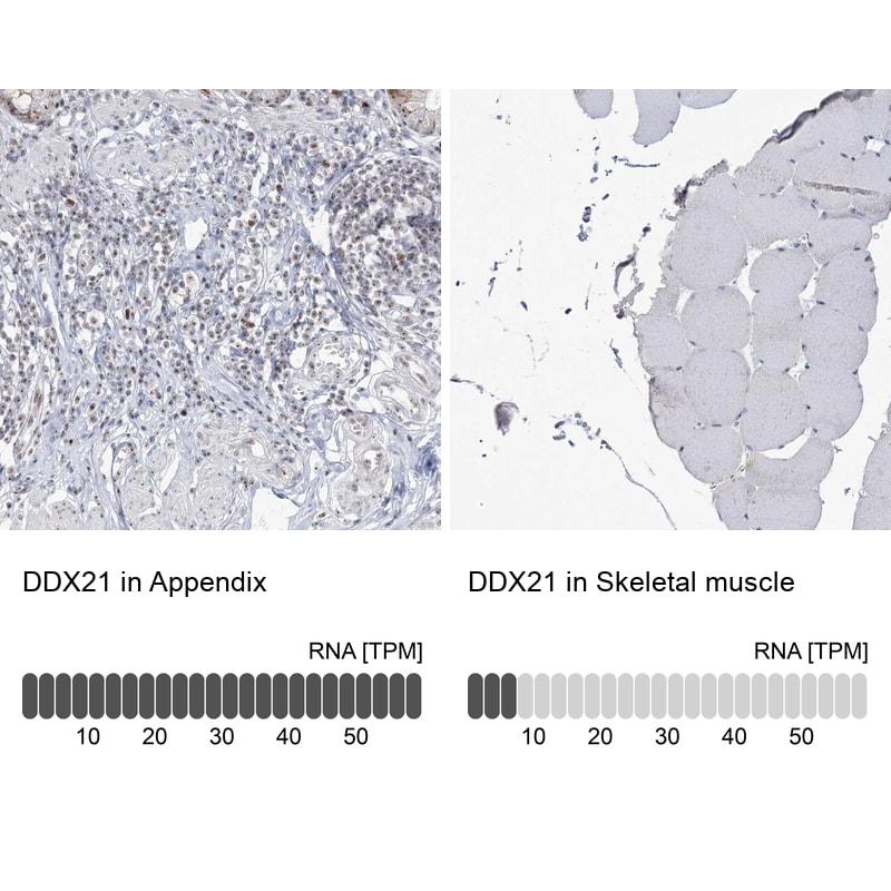 DDX21 Antibody in Immunohistochemistry (IHC)