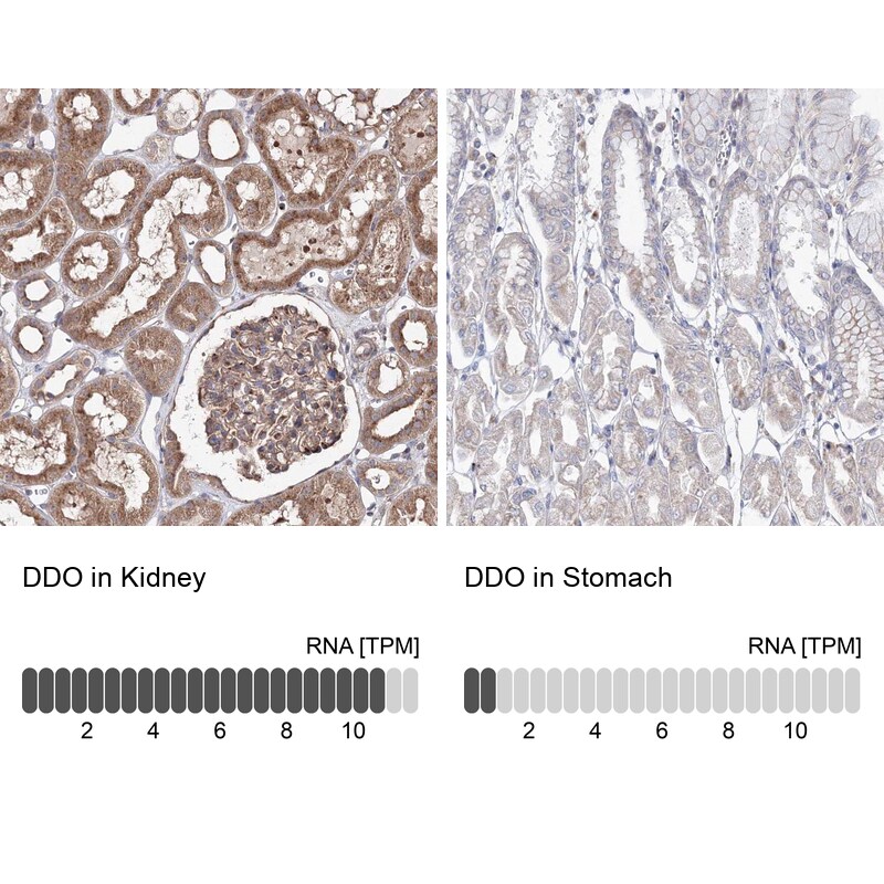 DDO Antibody in Immunohistochemistry (IHC)