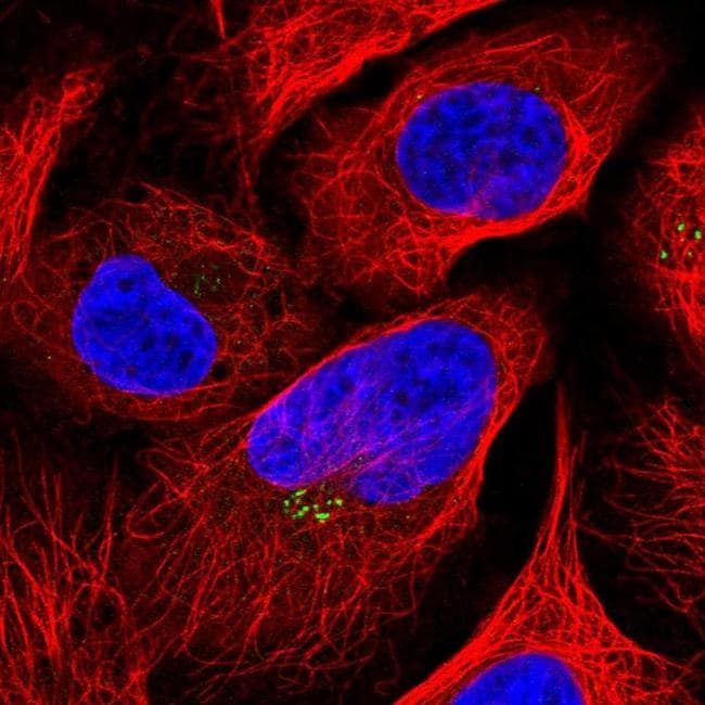 LOXL4 Antibody (PA5-58036)