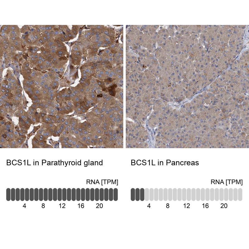 BCS1L Antibody in Immunohistochemistry (IHC)