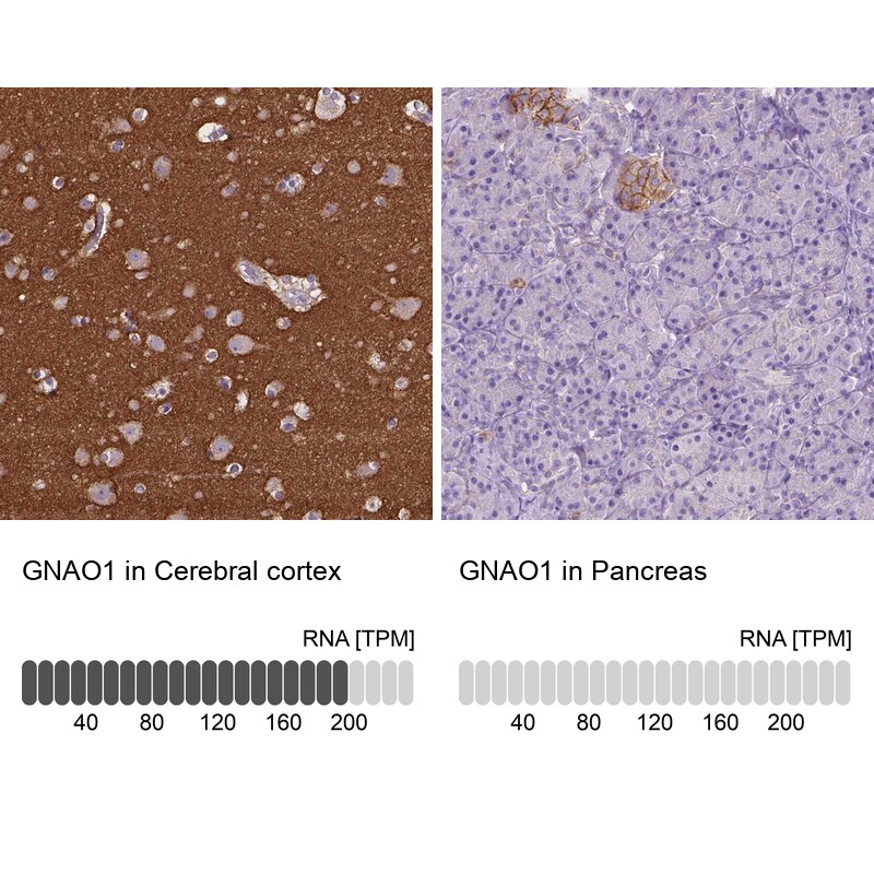 GNAO1 Antibody in Immunohistochemistry (IHC)