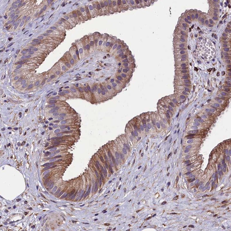 MRC2 Antibody (PA5-59810)