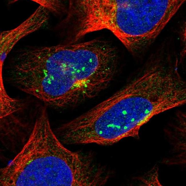 SUR1 Antibody (PA5-59947)