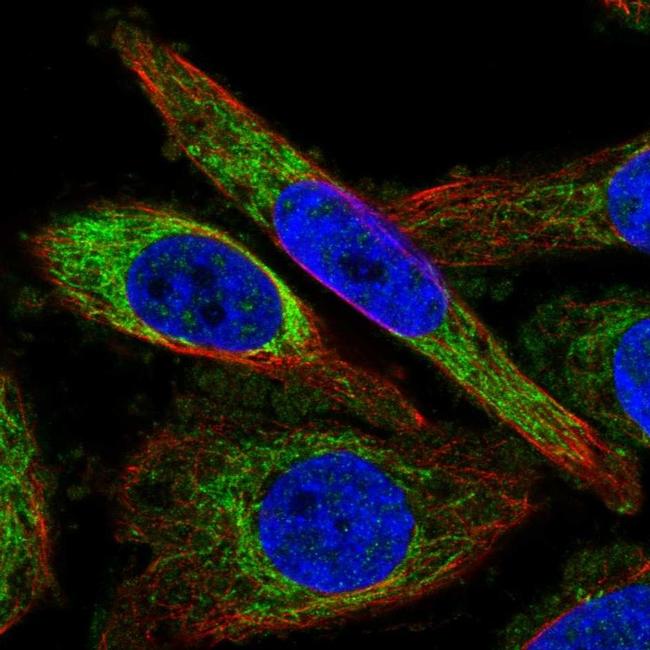 ZNF467 Antibody (PA5-60161)