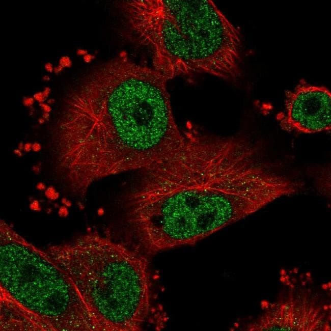 Snrnp70 Antibody (pa5-60398)