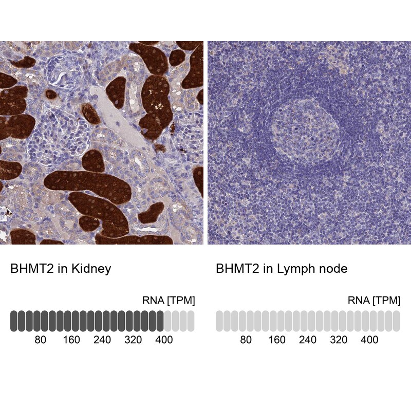 BHMT2 Antibody in Immunohistochemistry (IHC)