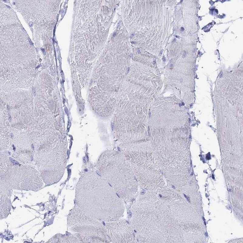 FUCA1 Antibody (PA5-61246)