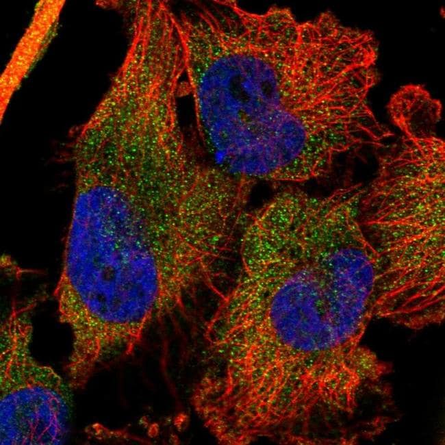 DDX60 Antibody (PA5-61380)