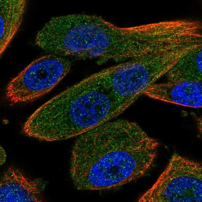 RNF31 Antibody (PA5-61812)