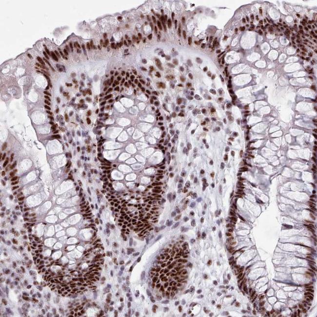 SRRM1 Antibody (PA5-62100)