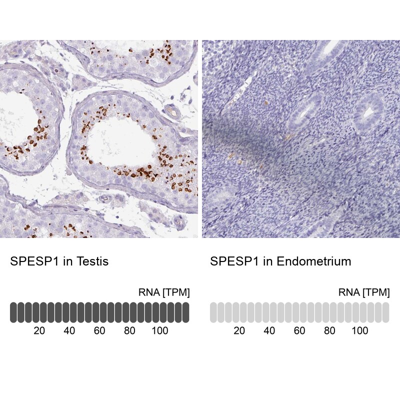 SPESP1 Antibody in Immunohistochemistry (IHC)