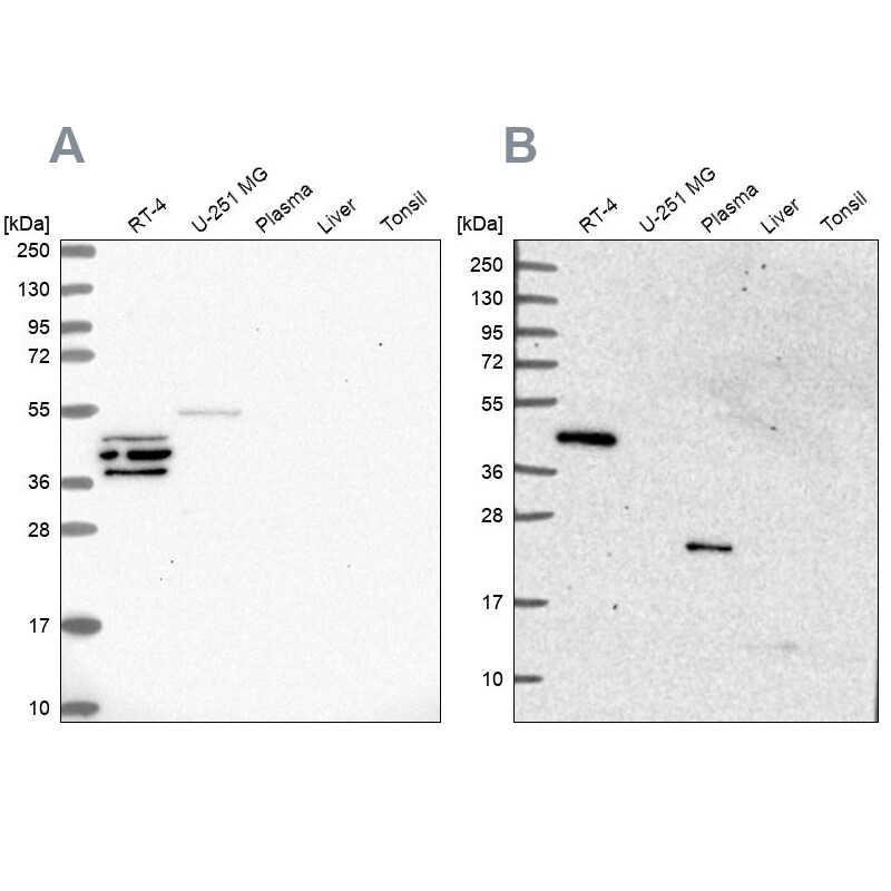 SPESP1 Antibody in Western Blot (WB)