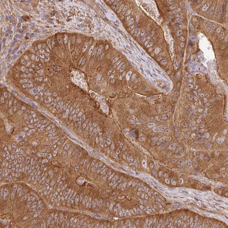 GSPT1 Antibody (PA5-62621)