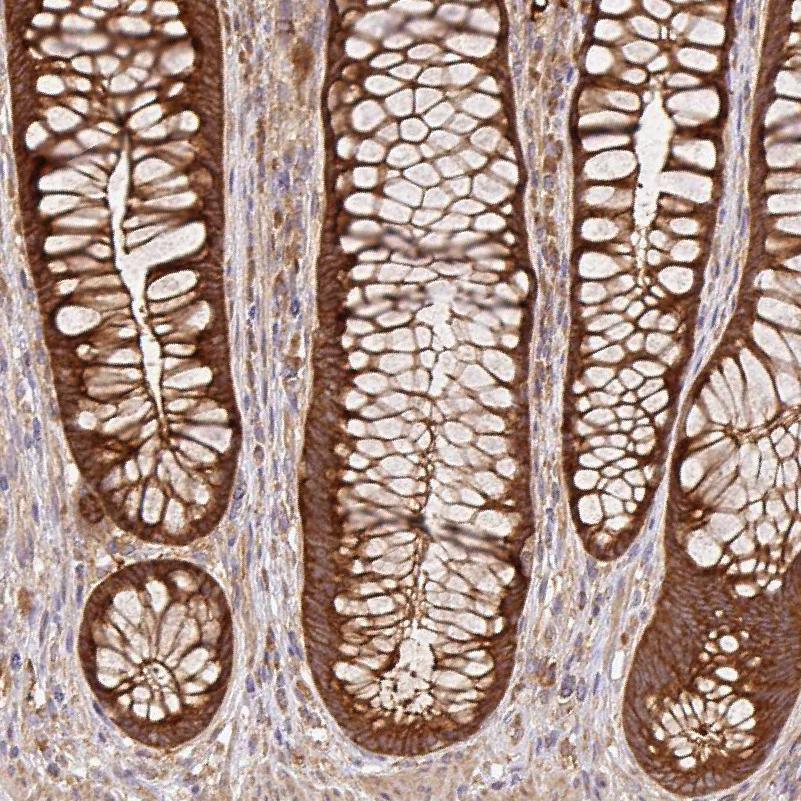 GSPT1 Antibody (PA5-62621)