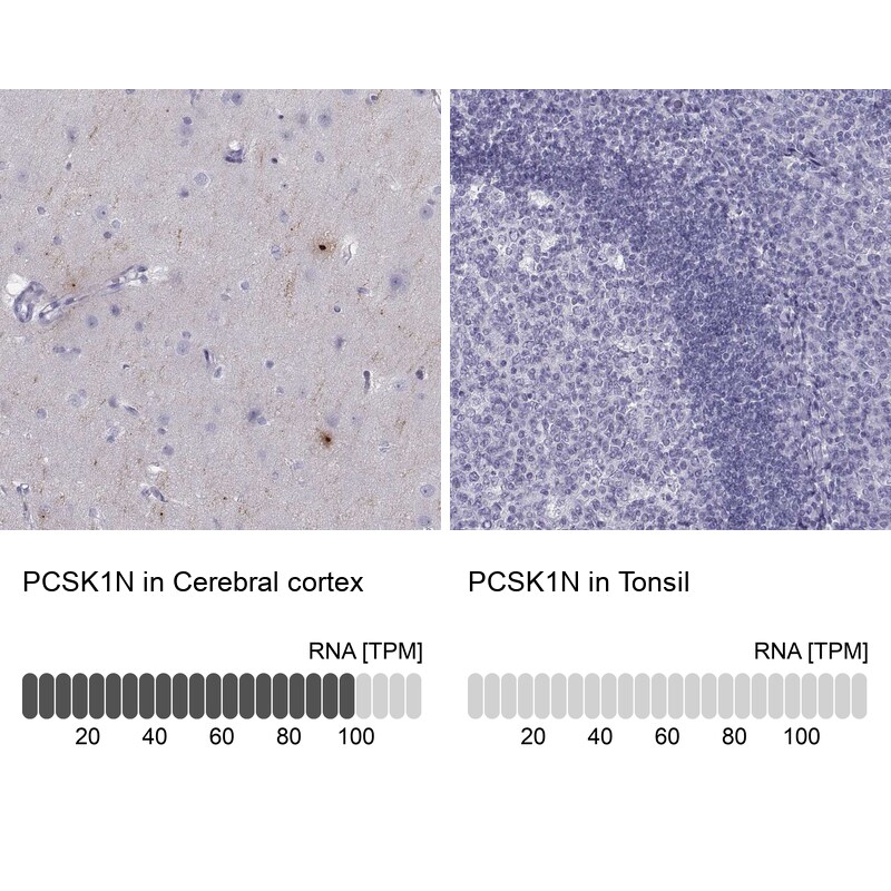 PCSK1N Antibody in Immunohistochemistry (IHC)