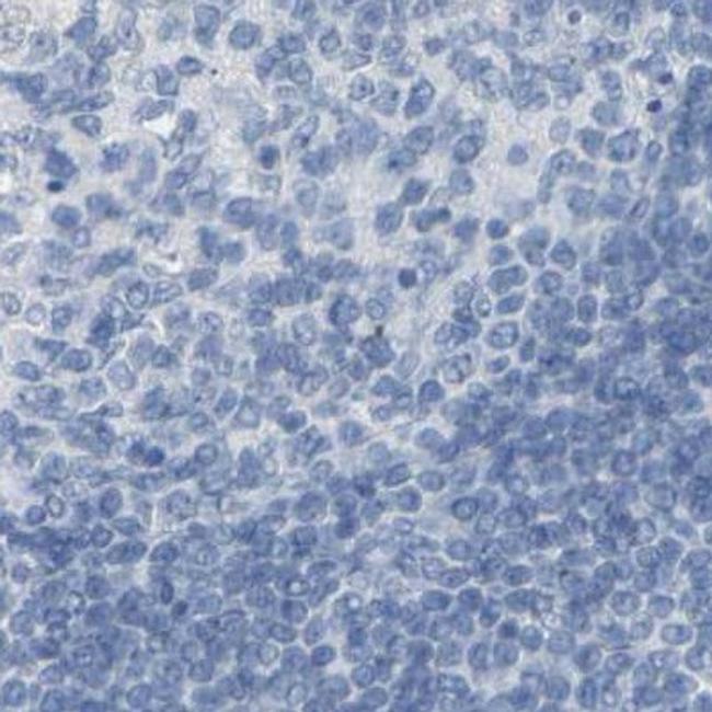 Opsin Blue Antibody (PA5-64948)