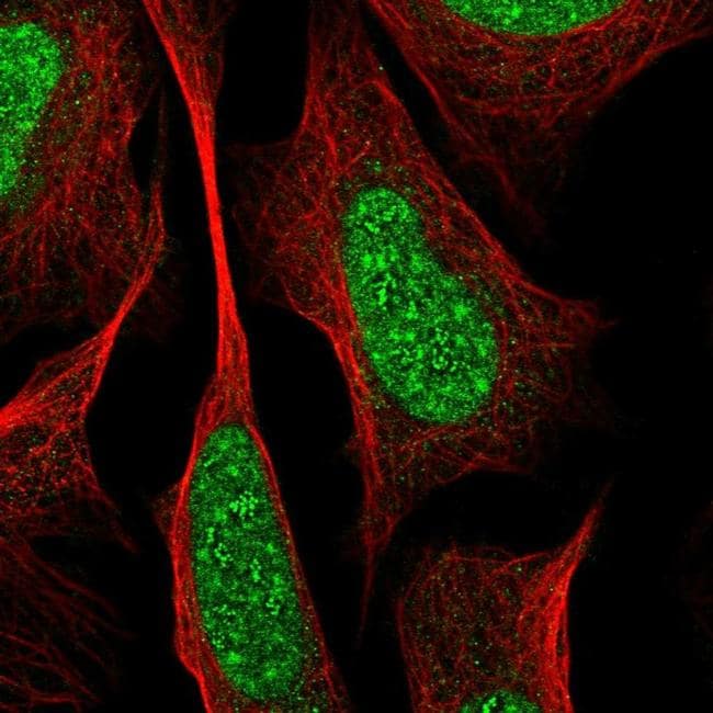 RREB1 Antibody (PA5-65129)