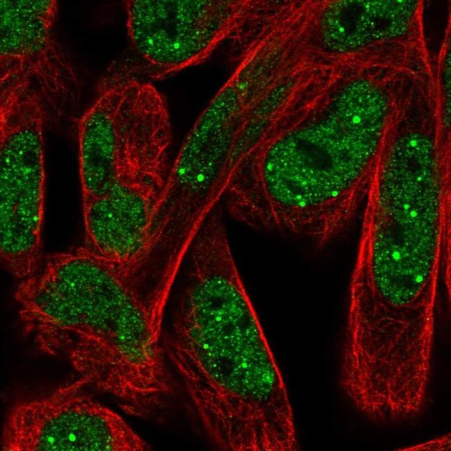 npat-antibody-pa5-65419