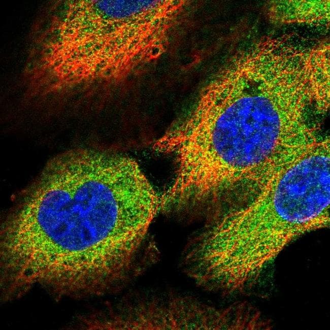 OSBPL3 Antibody (PA5-65513)