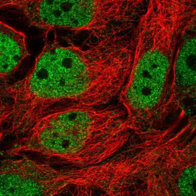 TFEB Antibody (PA5-65566)