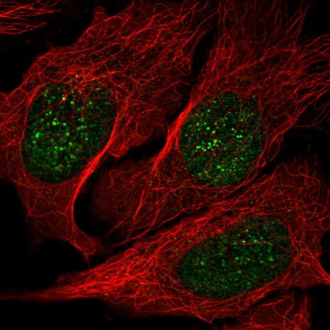 NME3 Antibody (PA5-65738)