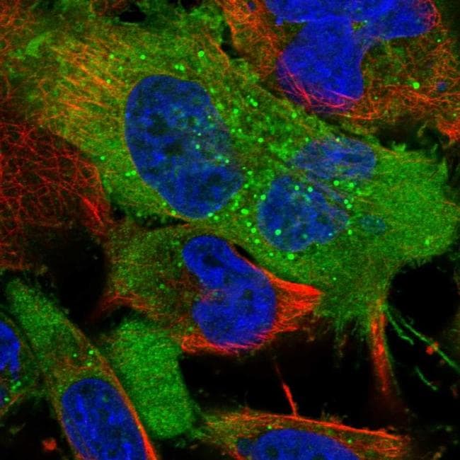 Neuropilin 2 Antibody (PA5-65910)