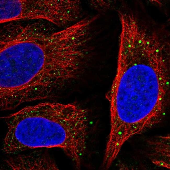 SLC14A1 Antibody (PA5-66162)