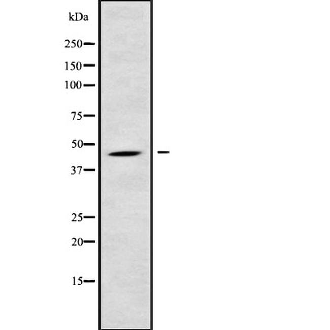 b4galt6-antibody-pa5-68113