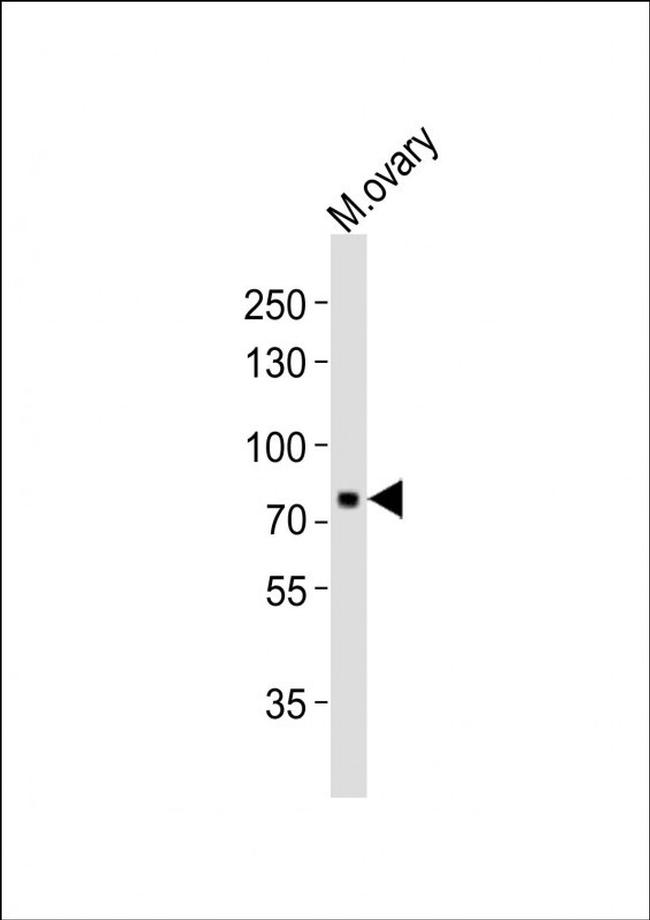 Maternal Embryonic Leucine Zipper Kinase Antibodies | AntibodyResource.com