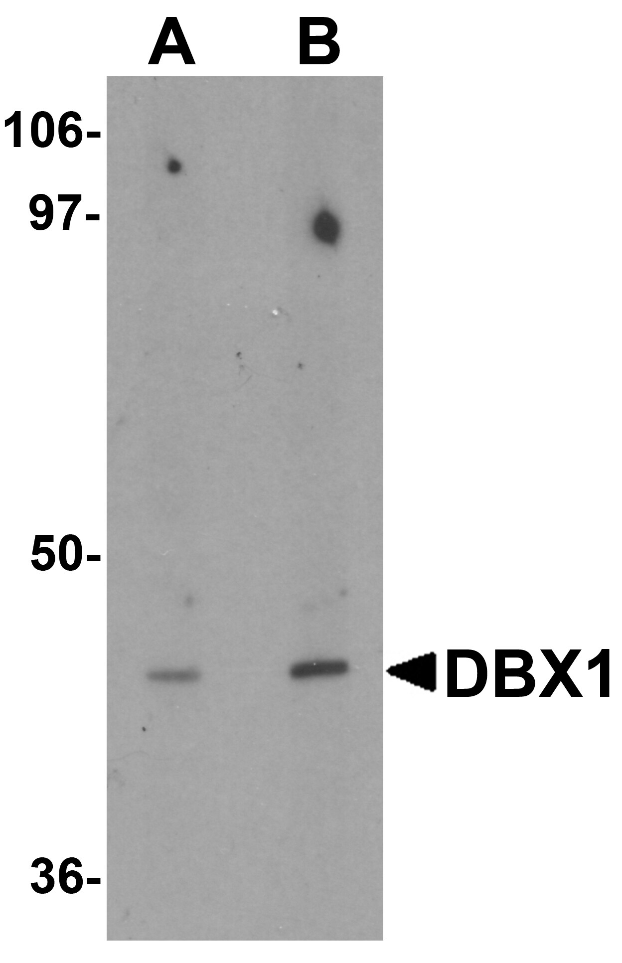 DBX1 Antibody (PA5-72697)