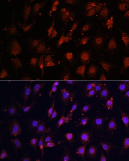 TET3 Antibody (PA5-76230)