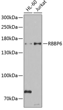 RBBP6 Antibody in Western Blot (WB)