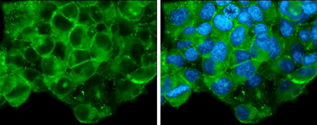 Glypican 3 Antibody (PA5-77986)